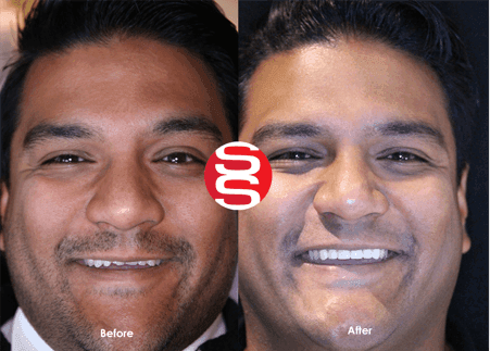 Ashley Before - After